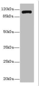 INVS / Inversin Antibody