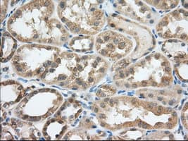 ERIC-1 / TACC3 Antibody (clone OTI1E4)
