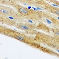 Polyclonal Rabbit anti-Human HAX-1 Antibody (IHC, IF, WB)