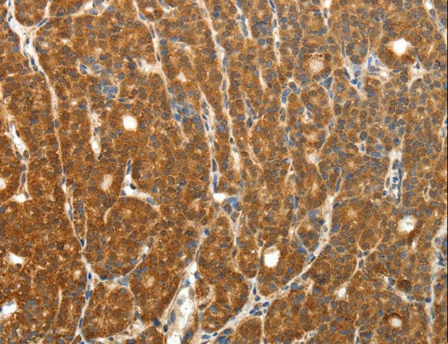 PTCH1 / Patched 1 Antibody