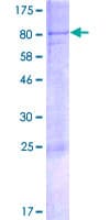 Human GLIS2 Protein (Recombinant GST)
