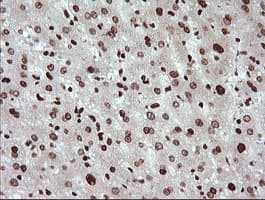 TRIM38 Antibody (clone OTI113D3)
