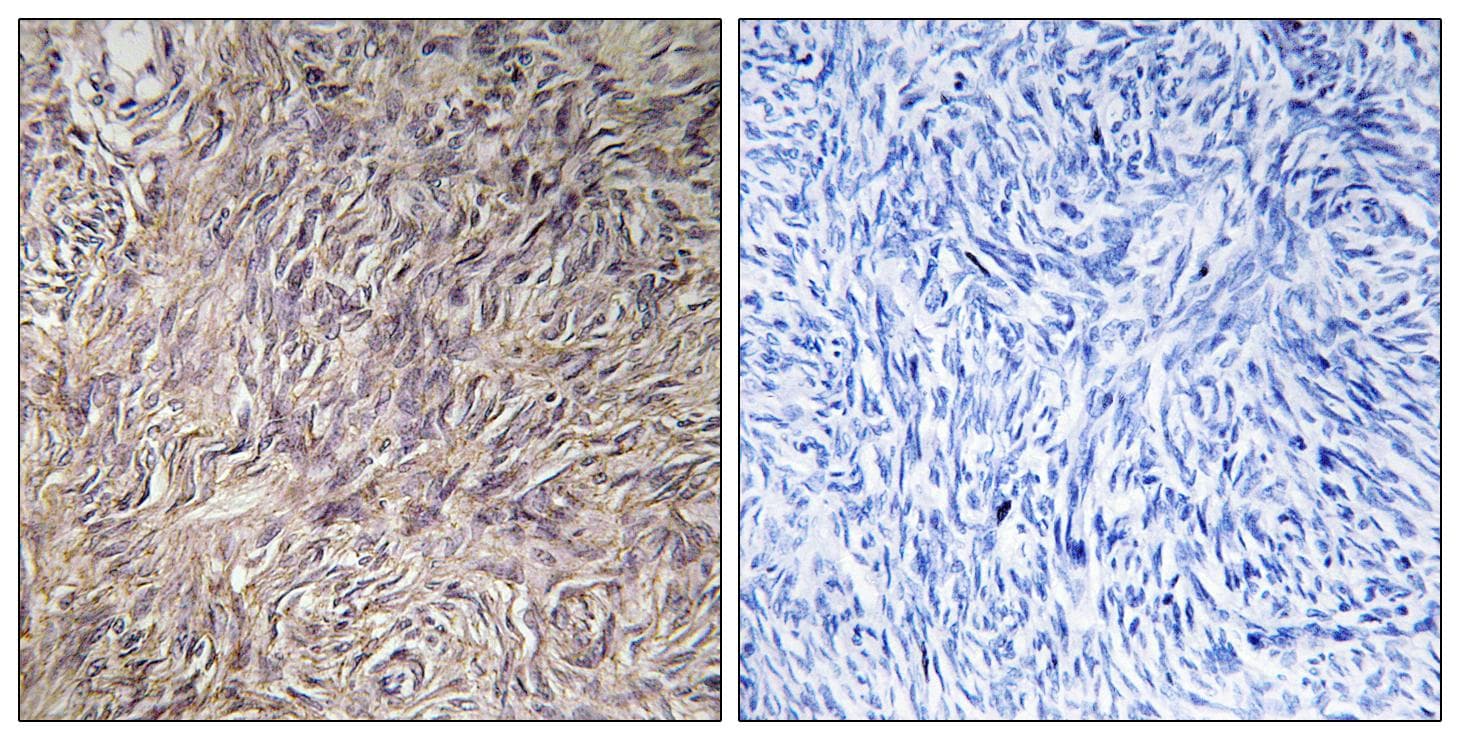 FGF22 Antibody