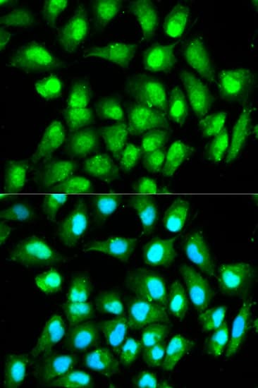Polyclonal Rabbit anti-Human RAN Antibody (IHC, IF, WB)