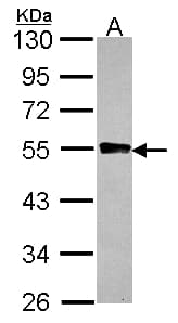 Polyclonal Rabbit anti-Human GYG2 Antibody (aa1-215, IHC, WB)