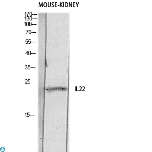 IL22 Antibody