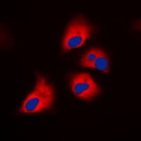 Polyclonal Rabbit anti-Human RPS6KB1 / P70S6K / S6K Antibody (phospho-Thr444, IHC, IF, WB)