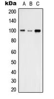 Polyclonal Rabbit anti-Human VAV2 Antibody (N-Terminus, IF, WB)