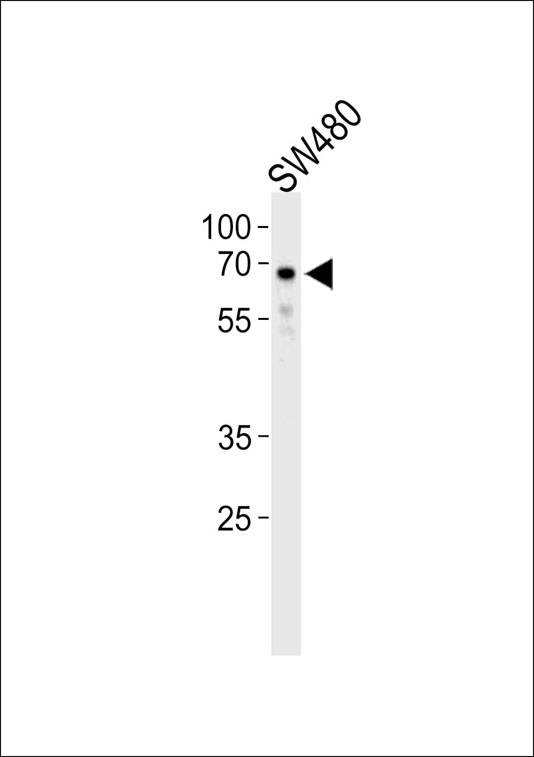TRIM29 Antibody (aa336-365)