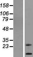 Human TM4SF20 Protein (Over-Expression Lysate Myc-DDK (Flag))