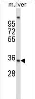 UPRT Antibody (aa204-233)