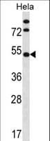 IP6K1 Antibody (aa86-115)