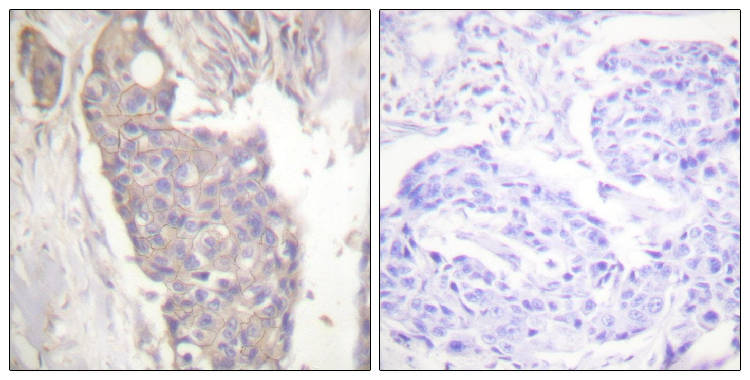 CD95 / FAS Antibody