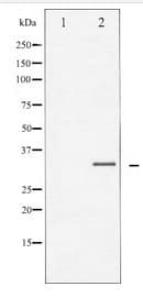Polyclonal Rabbit anti-Human C/EBP Beta / CEBPB Antibody (IHC, WB)