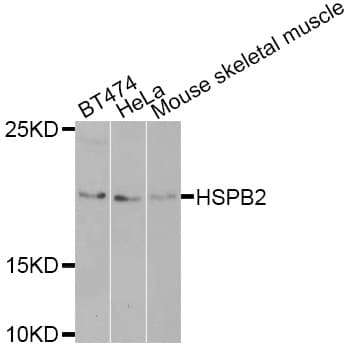 HSPB2 / HSP27 Antibody