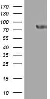 PARN Antibody (aa1-266, clone OTI4D6)