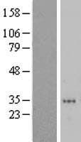 ZNF705D Protein (Over-Expression Lysate Myc-DDK (Flag))