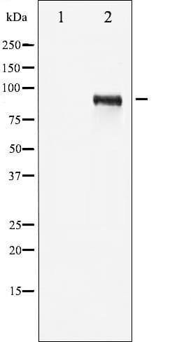 IGF1R / IGF1 Receptor Antibody (phospho-Tyr1161)