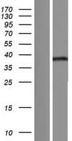 MBNL3 Protein (Over-Expression Lysate Myc-DDK (Flag))