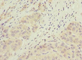 Polyclonal Rabbit anti-Human JADE1 / PHF17 Antibody (IHC)
