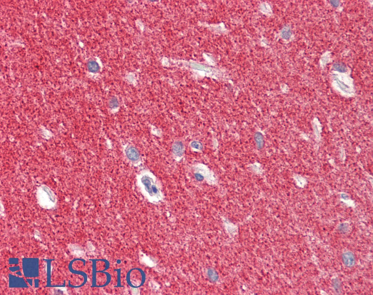 PathPlus™ SNCA / Alpha-Synuclein Antibody (aa91-102)