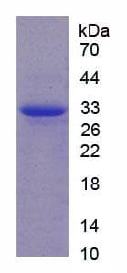 Rat CAPN1 / Calpain 1 Protein (Recombinant His)