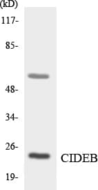 Polyclonal Rabbit anti-Human CIDEB Antibody (aa68-117, IHC, WB)