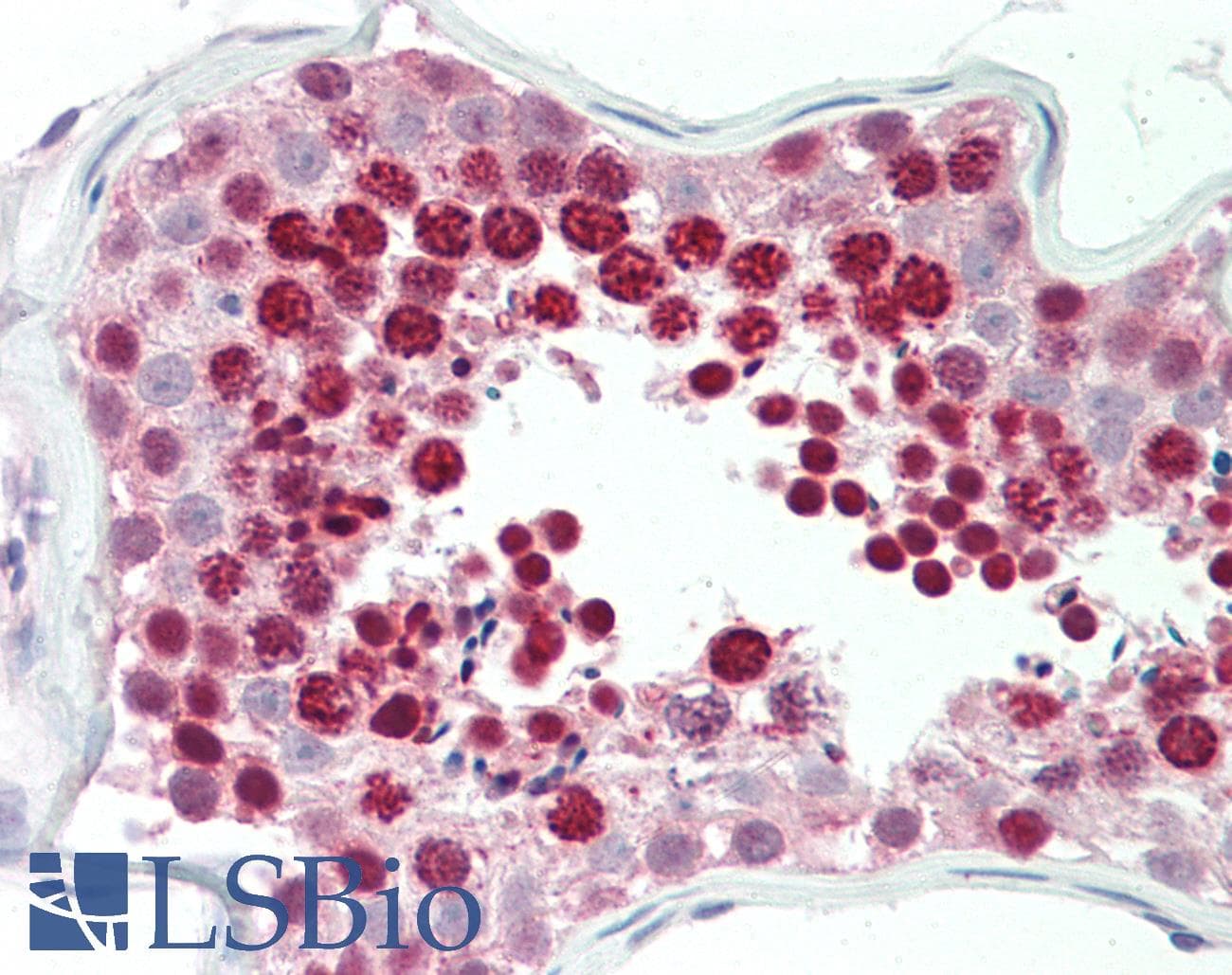IHC-plus™ HOXA10 Antibody (aa152-165)