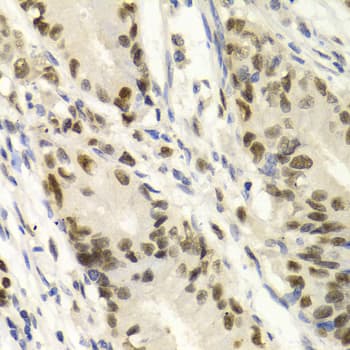 QIP1 / KPNA4 Antibody