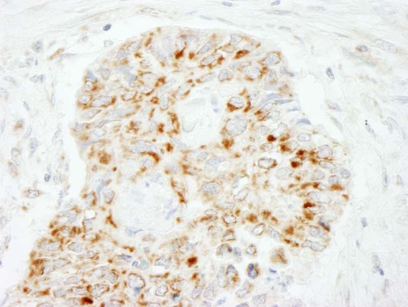 VISA / MAVS Antibody (aa150-200)