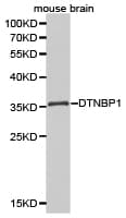DTNBP1 / Dysbindin Antibody