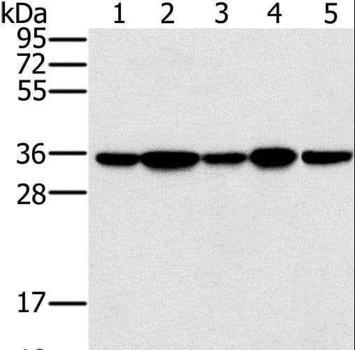 PPP1CC / PP1 Gamma Antibody