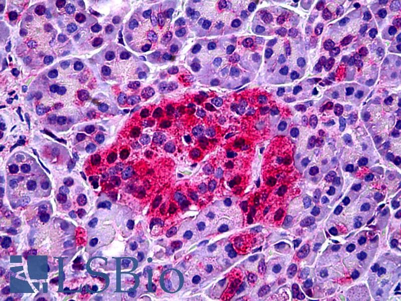 IHC-plus™ NTSR1 / NTR Antibody (aa181-230)