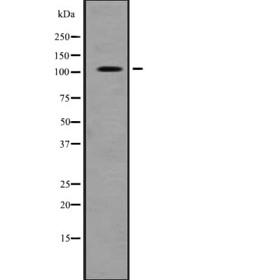 RASA1 Antibody