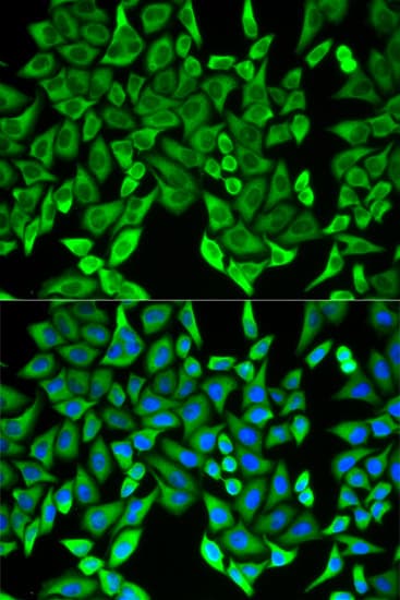 IHC-plus™ MOG Antibody