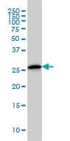 CLIC3 Antibody (clone 3F8)