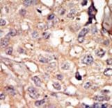 Polyclonal Rabbit anti-Human NUAK1 / ARK5 Antibody (aa1-30, IHC, WB)