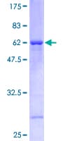 Human RFC2 / RFC40 Protein (Recombinant GST)