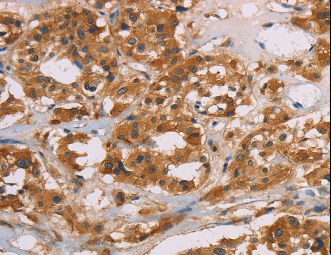CD22 Antibody