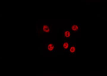 Polyclonal Rabbit anti-Human RALY Antibody (IF, WB)
