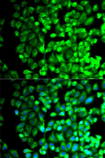 IHC-plus™ TS / Thromboxane Synthase Antibody