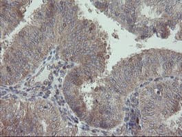 RIPK1 / RIP Antibody (aa133-422, clone OTI2D6, Carrier-free)