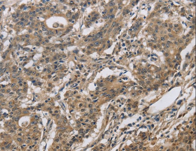 DHRS3 / SDR1 Antibody
