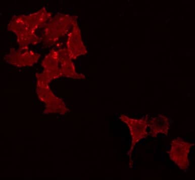 Polyclonal Rabbit anti-Human STON1 Antibody (IF, WB)