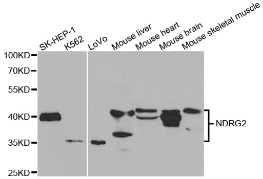Polyclonal Rabbit anti-Human NDRG2 Antibody (IHC, WB)
