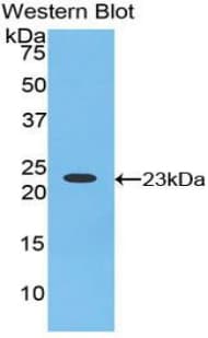 HRNR / Hornerin Antibody (aa2685-2850, APC, Cy7)