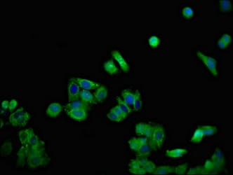 DSG1 / Desmoglein 1 Antibody