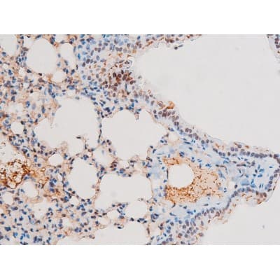 Polyclonal Rabbit anti-Human RELA / NFKB p65 Antibody (phospho-Thr435, IHC, IF, WB)