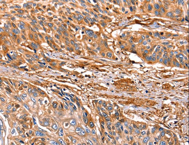 LGALS1 / Galectin 1 Antibody