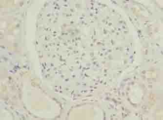 C5orf24 Antibody